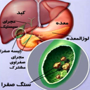 همه چیز درباره کیسه صفرا
