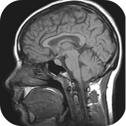 دانلود MRI Viewer
