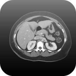 دانلود Radiology CT Viewer