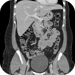 دانلود CT Abdomen Pelvis