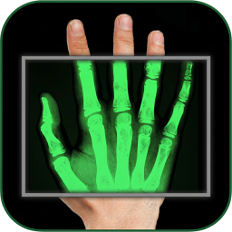 دانلود Xray scan filter camera