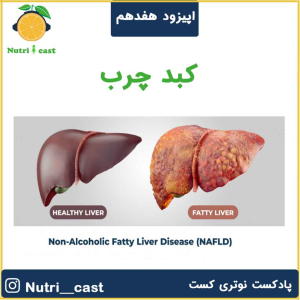 پادکست نوتری کست - فصل ۱ - اپیزود هفده : کبد چرب