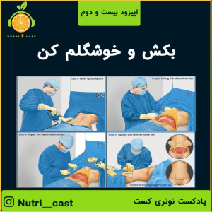 پادکست نوتری کست - فصل ۱ - اپیزود بیست و دو : بکش و خوشگلم کن