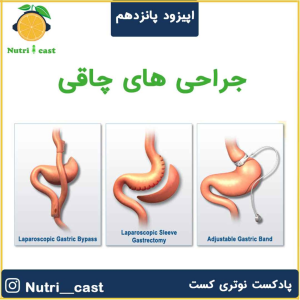 پادکست نوتری کست - فصل ۱ - اپیزود پانزده : جراحی های چاقی