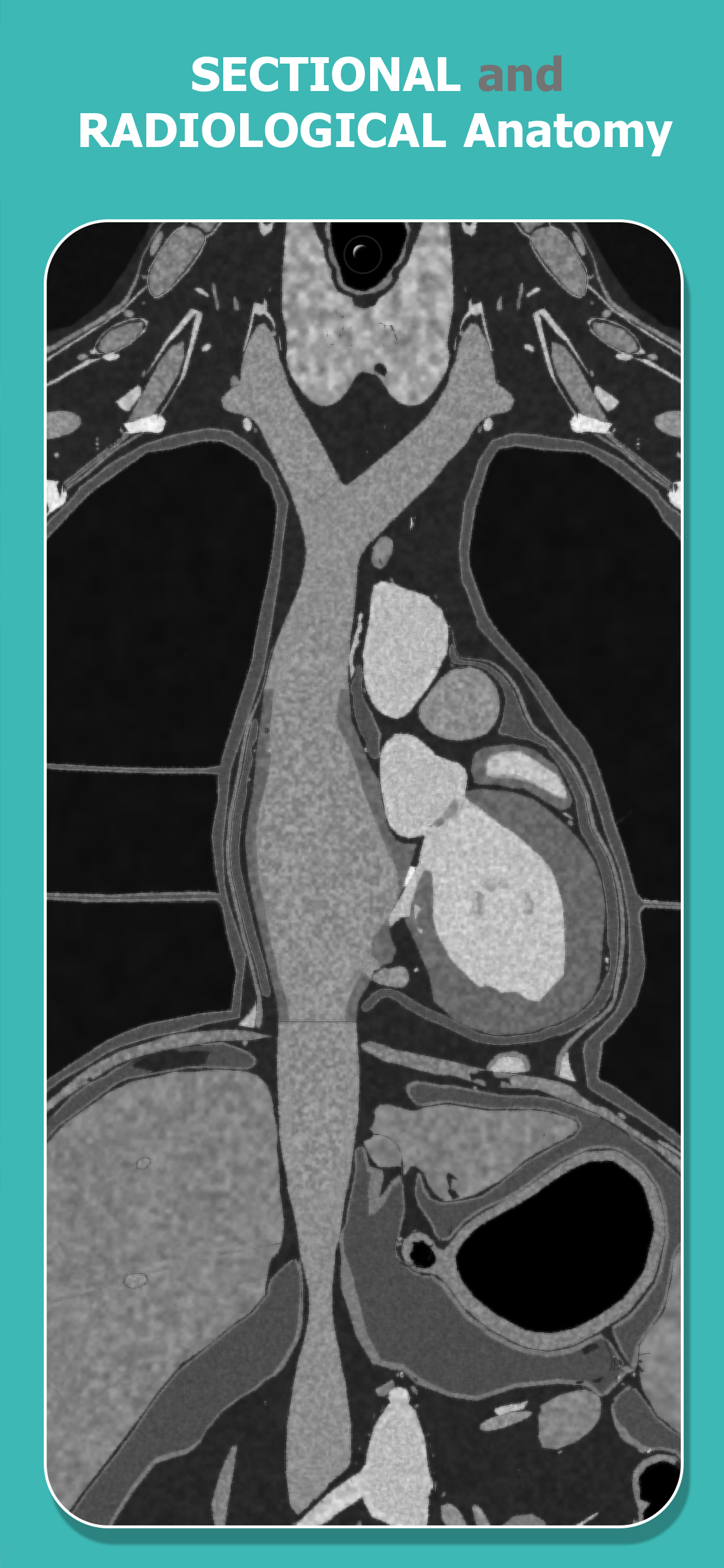 اسکرین شات 3 برنامه Anatomy Learning - 3D Anatomy