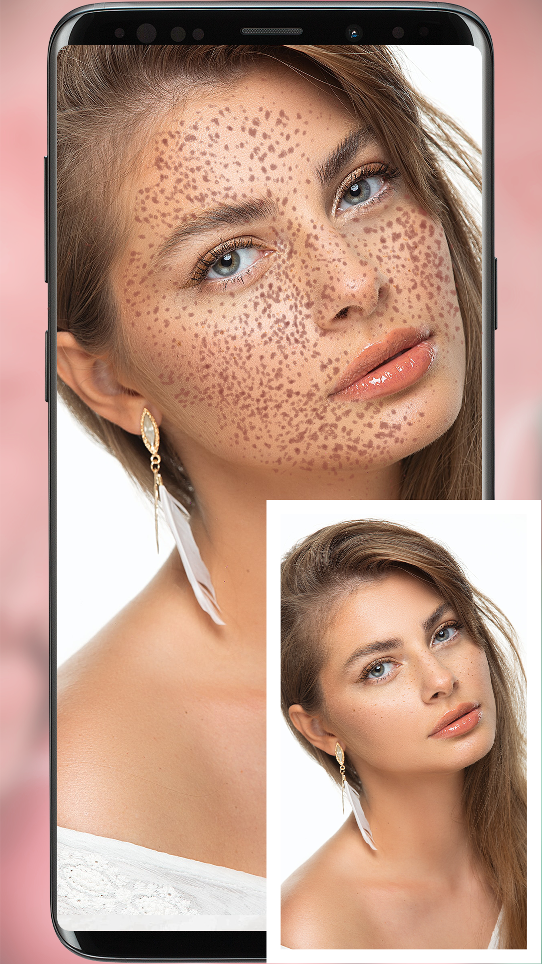 اسکرین شات 1 برنامه Freckles Filter Camera