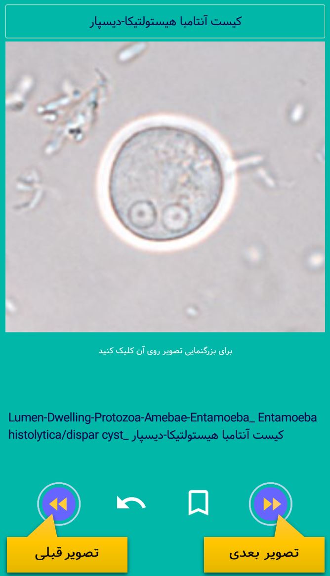 اسکرین شات 3 برنامه اطلس انگل شناسی پزشکی