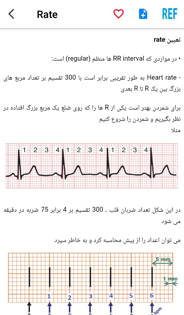 اسکرین شات 6 برنامه مرور نوار قلب ECG review