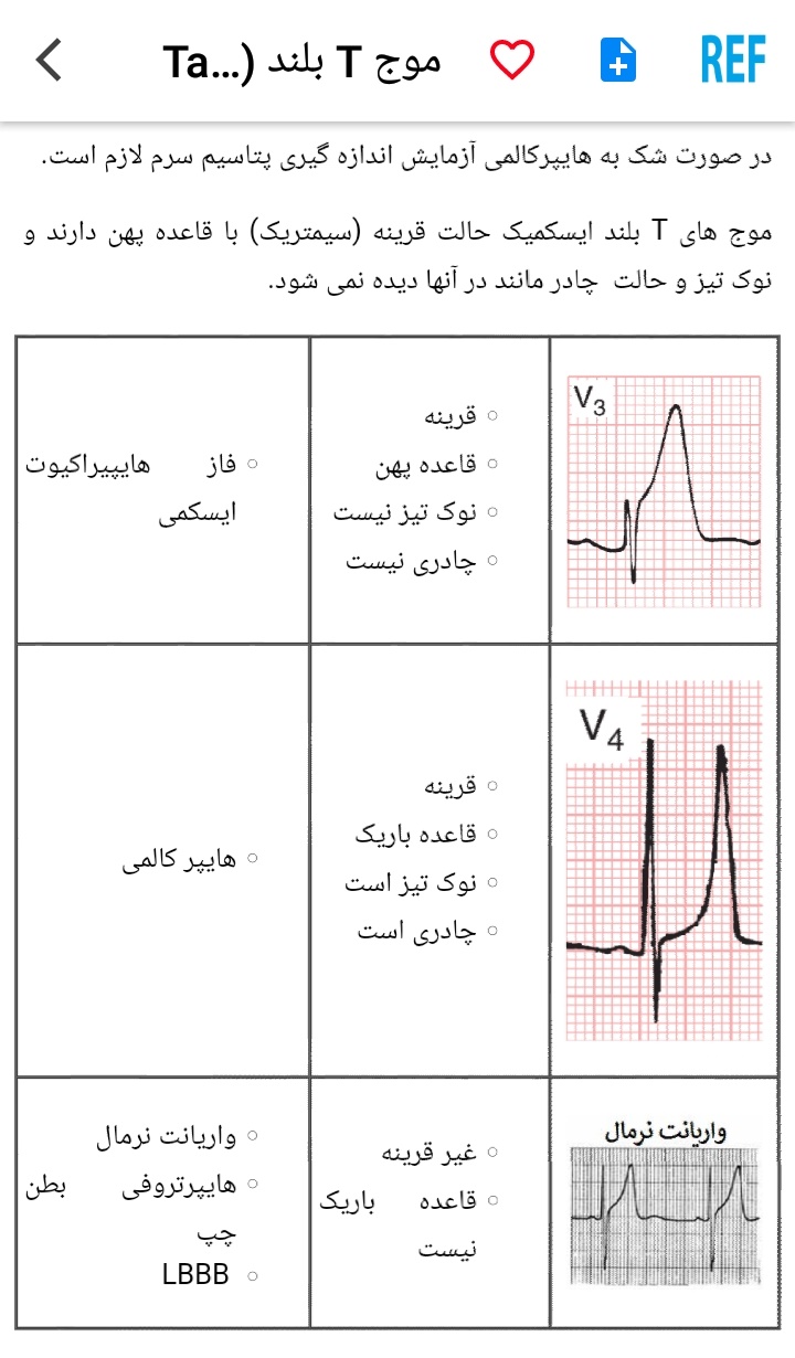 اسکرین شات 8 برنامه مرور نوار قلب ECG review
