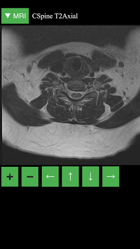 اسکرین شات 4 برنامه MRI Viewer