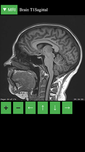 اسکرین شات 2 برنامه MRI Viewer