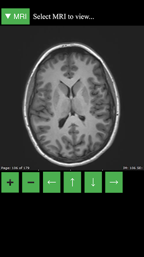 اسکرین شات 1 برنامه MRI Viewer