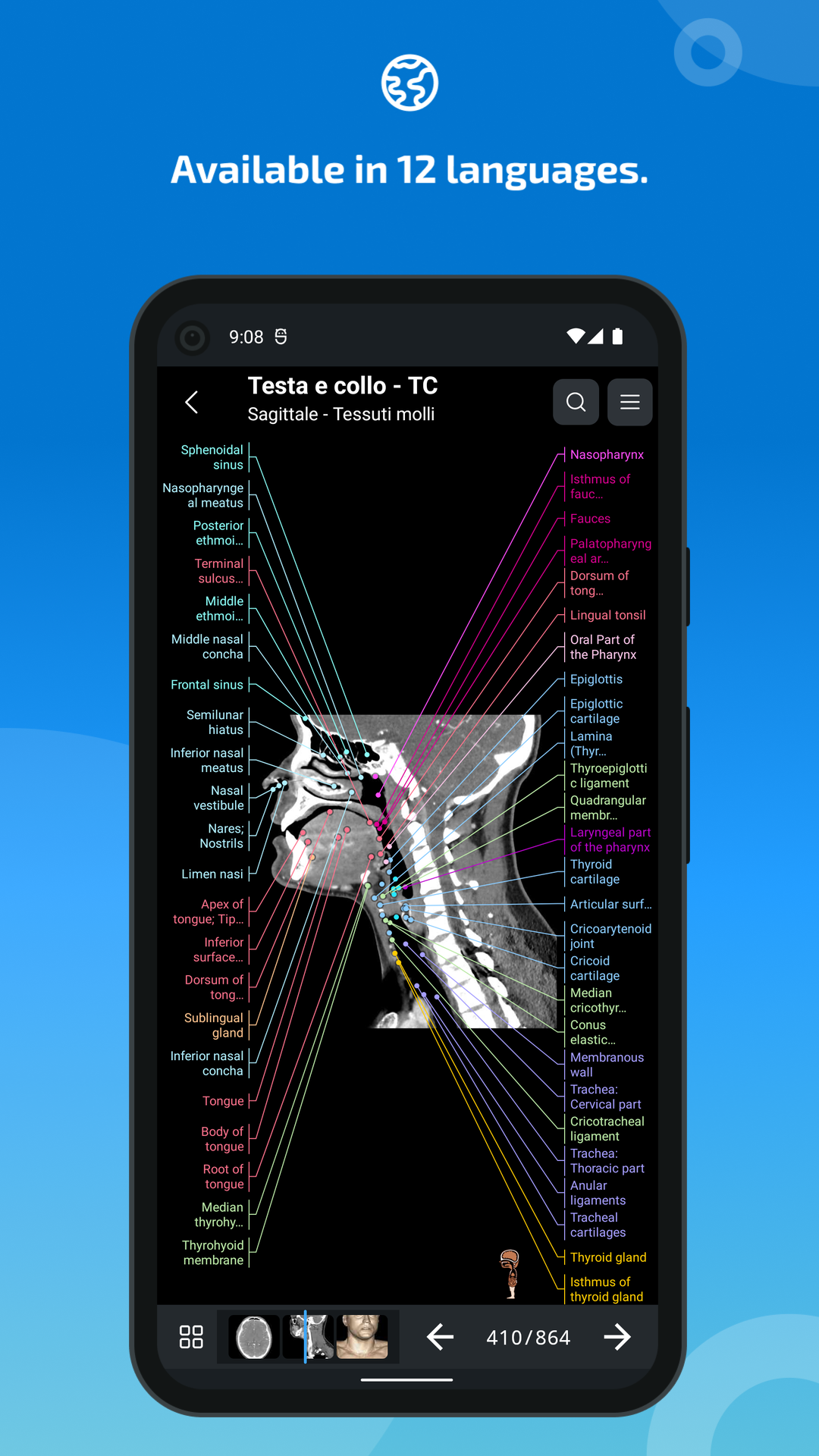 اسکرین شات 7 برنامه IMAIOS e-Anatomy