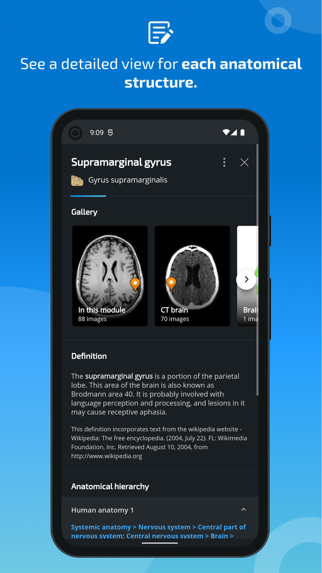اسکرین شات 5 برنامه IMAIOS e-Anatomy