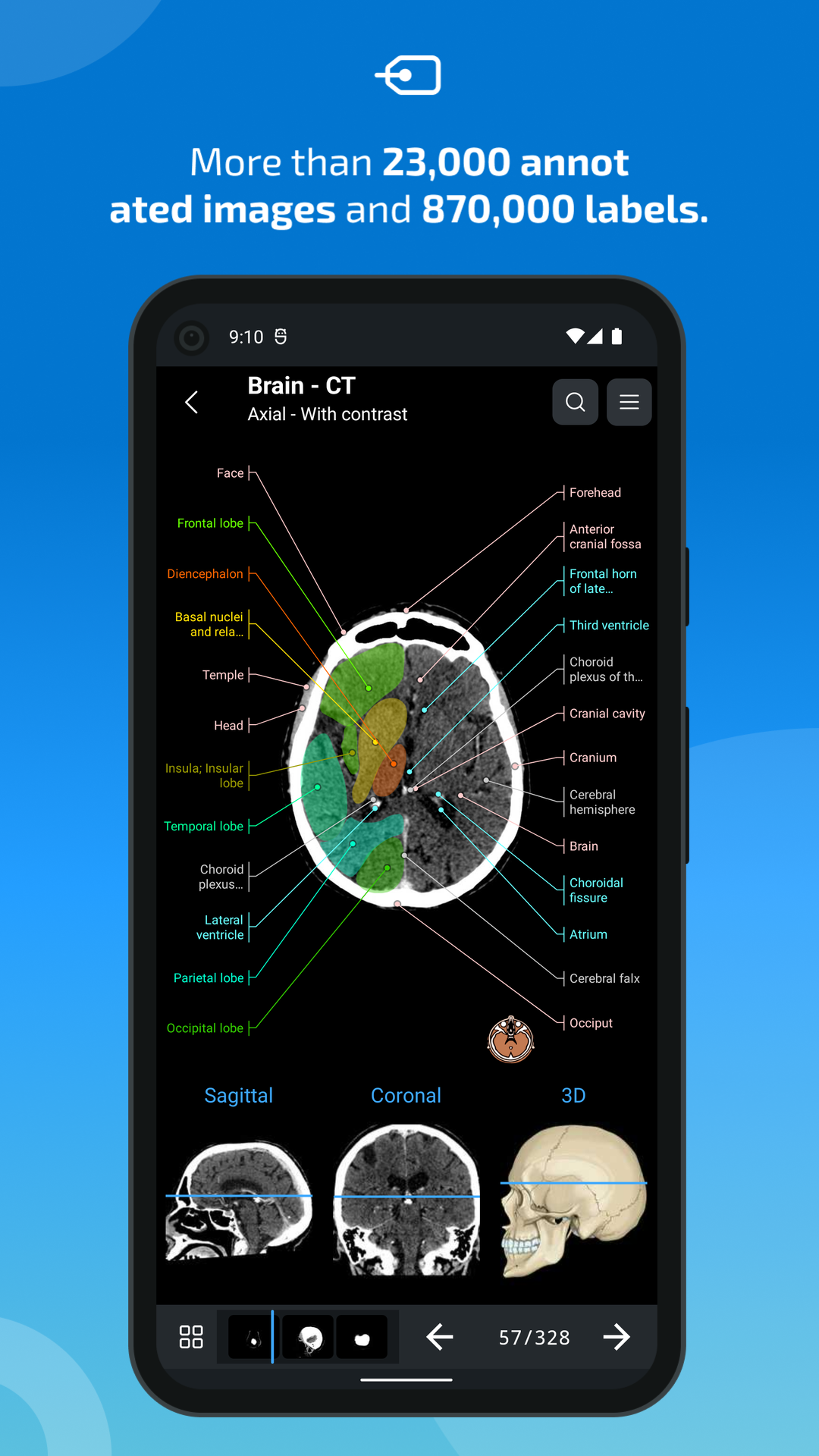 اسکرین شات 2 برنامه IMAIOS e-Anatomy