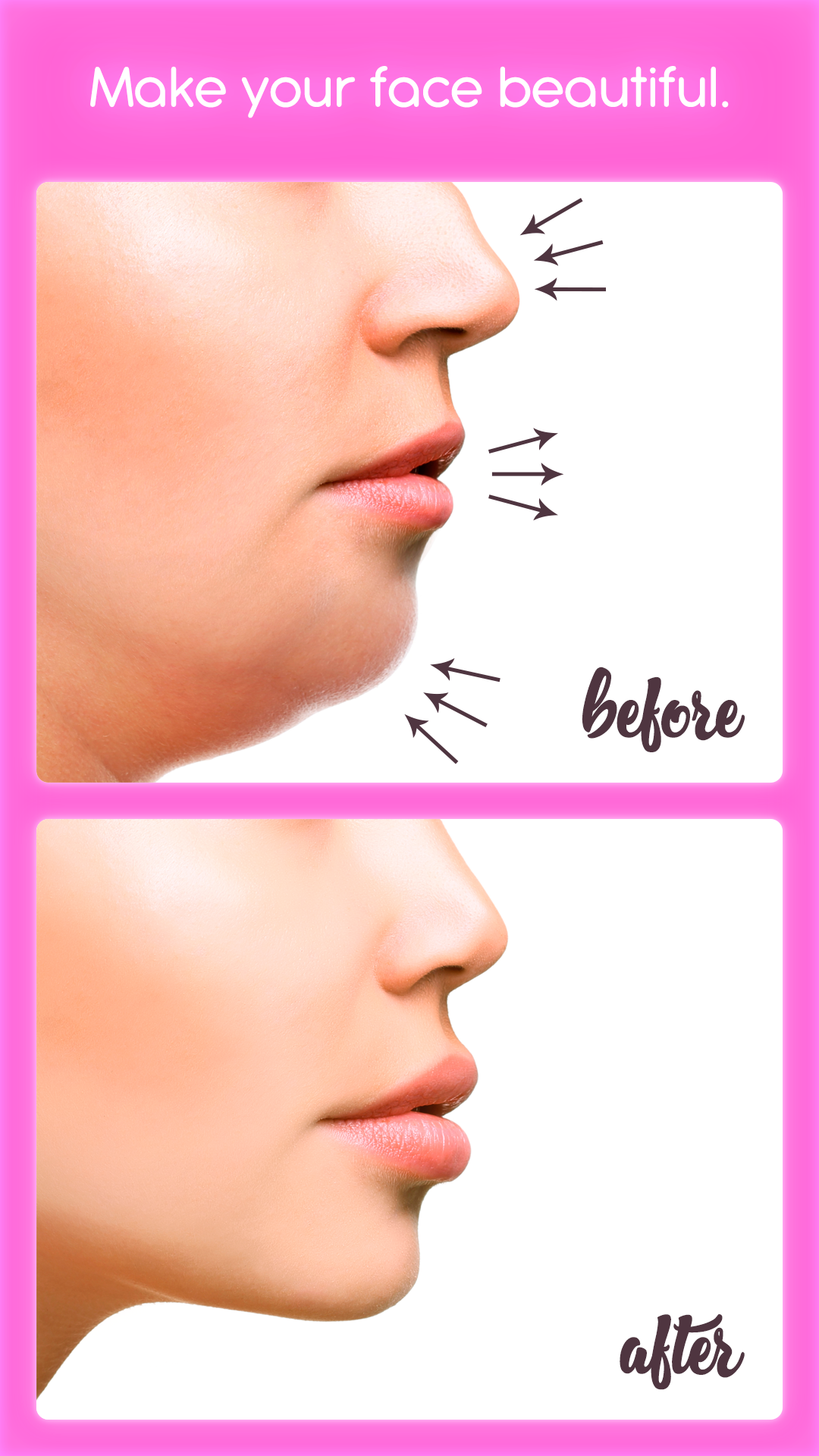 اسکرین شات 1 برنامه Rhinoplasty