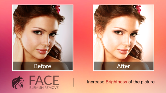 اسکرین شات 4 برنامه Blemishes Remover You Makeup