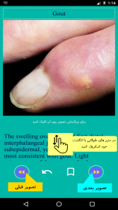 اسکرین شات 2 برنامه آسکی بیماریهای داخلی