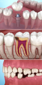 اسکرین شات 7 برنامه Dental 3D Illustrations