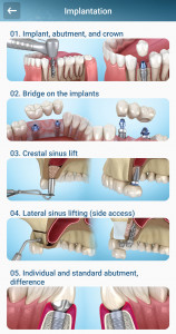اسکرین شات 3 برنامه Dental 3D Illustrations