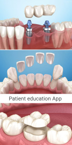 اسکرین شات 8 برنامه Dental 3D Illustrations