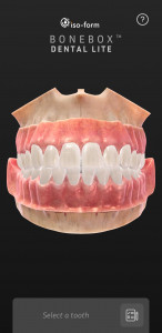 اسکرین شات 1 برنامه BoneBox™ - Dental Lite