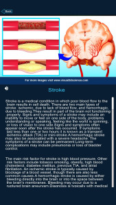 اسکرین شات 8 برنامه Brain Anatomy Pro.