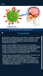 اسکرین شات 5 برنامه Brain Anatomy Pro.