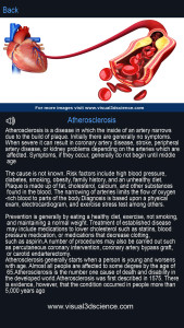 اسکرین شات 4 برنامه Heart Anatomy Pro.
