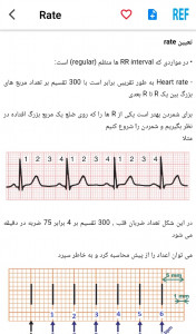 اسکرین شات 6 برنامه مرور نوار قلب ECG review