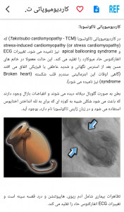 اسکرین شات 9 برنامه مرور نوار قلب ECG review