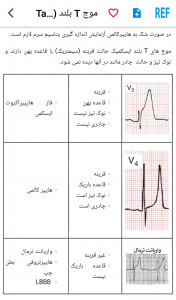 اسکرین شات 8 برنامه مرور نوار قلب ECG review
