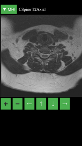 اسکرین شات 4 برنامه MRI Viewer