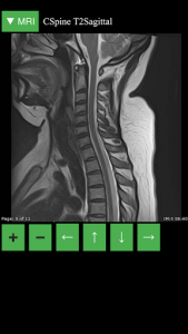 اسکرین شات 3 برنامه MRI Viewer