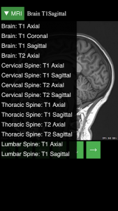 اسکرین شات 5 برنامه MRI Viewer