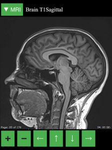 اسکرین شات 7 برنامه MRI Viewer