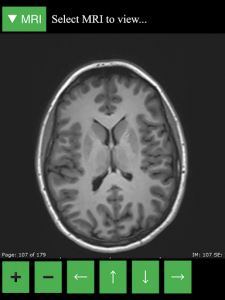 اسکرین شات 6 برنامه MRI Viewer
