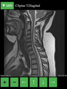 اسکرین شات 8 برنامه MRI Viewer