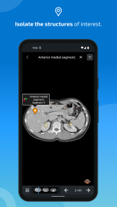 اسکرین شات 4 برنامه IMAIOS e-Anatomy