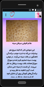 اسکرین شات 1 برنامه سرطان سینه