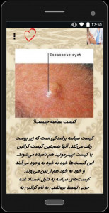 اسکرین شات 4 برنامه راه های درمان کیست‌ها